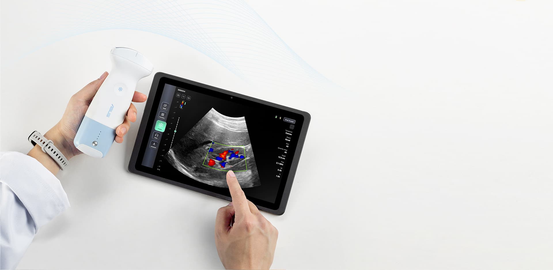 ASUS LU800 handheld ultrasound probe scanning wirelessly to a tablet