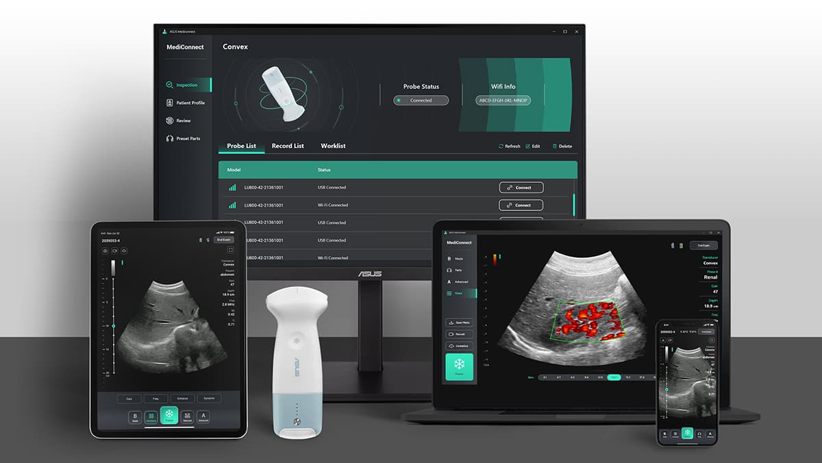ASUS MediConnect app running on a monitor, tablet, laptop, and phone alongside the LU800 probe
