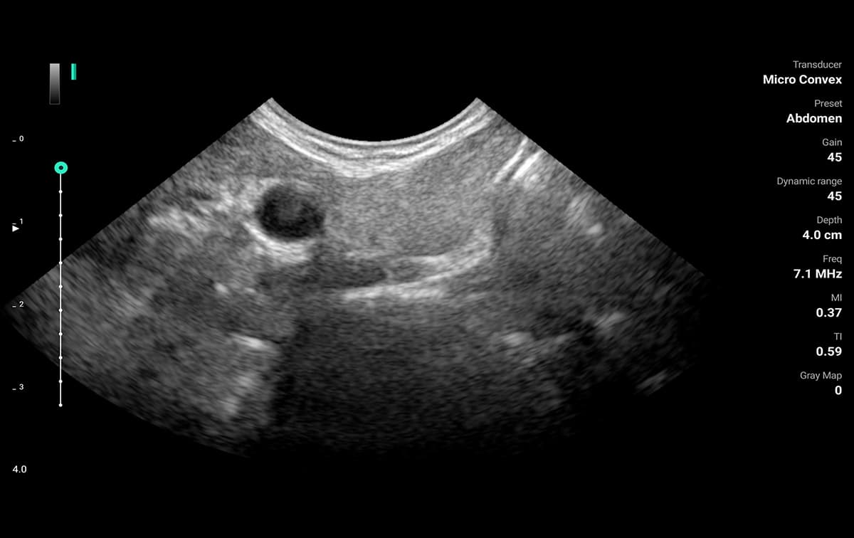 Abdominal B-mode image on the ASUS LU800M microconvex probe