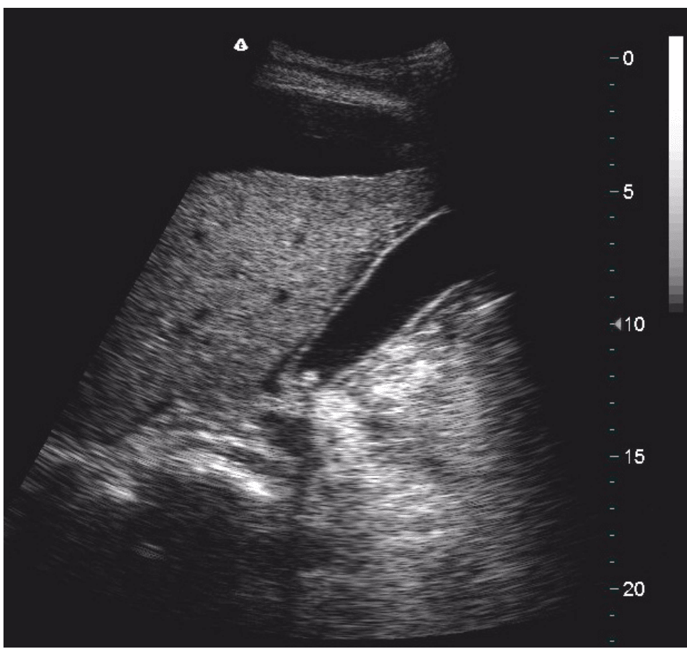 Terason B-Mode example scan