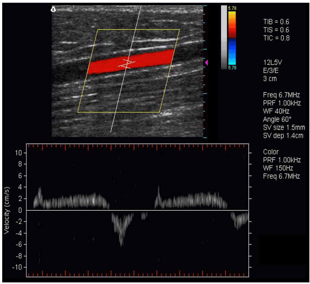 Terason Triplex example scan