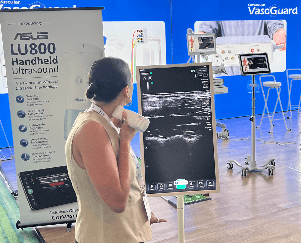 Attendee performing a carotid scan with the ASUS LU800 wireless handheld ultrasound at the CorVascular booth, SVU 2026