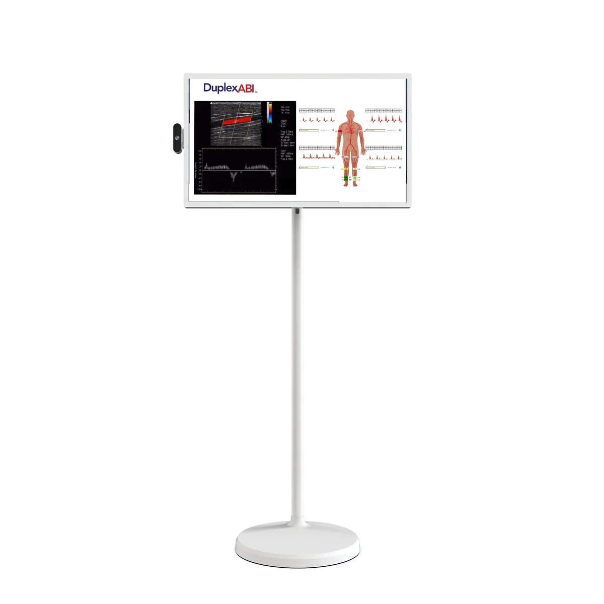 24-inch rolling display showing a DuplexABI screen with a duplex scan and ABI results