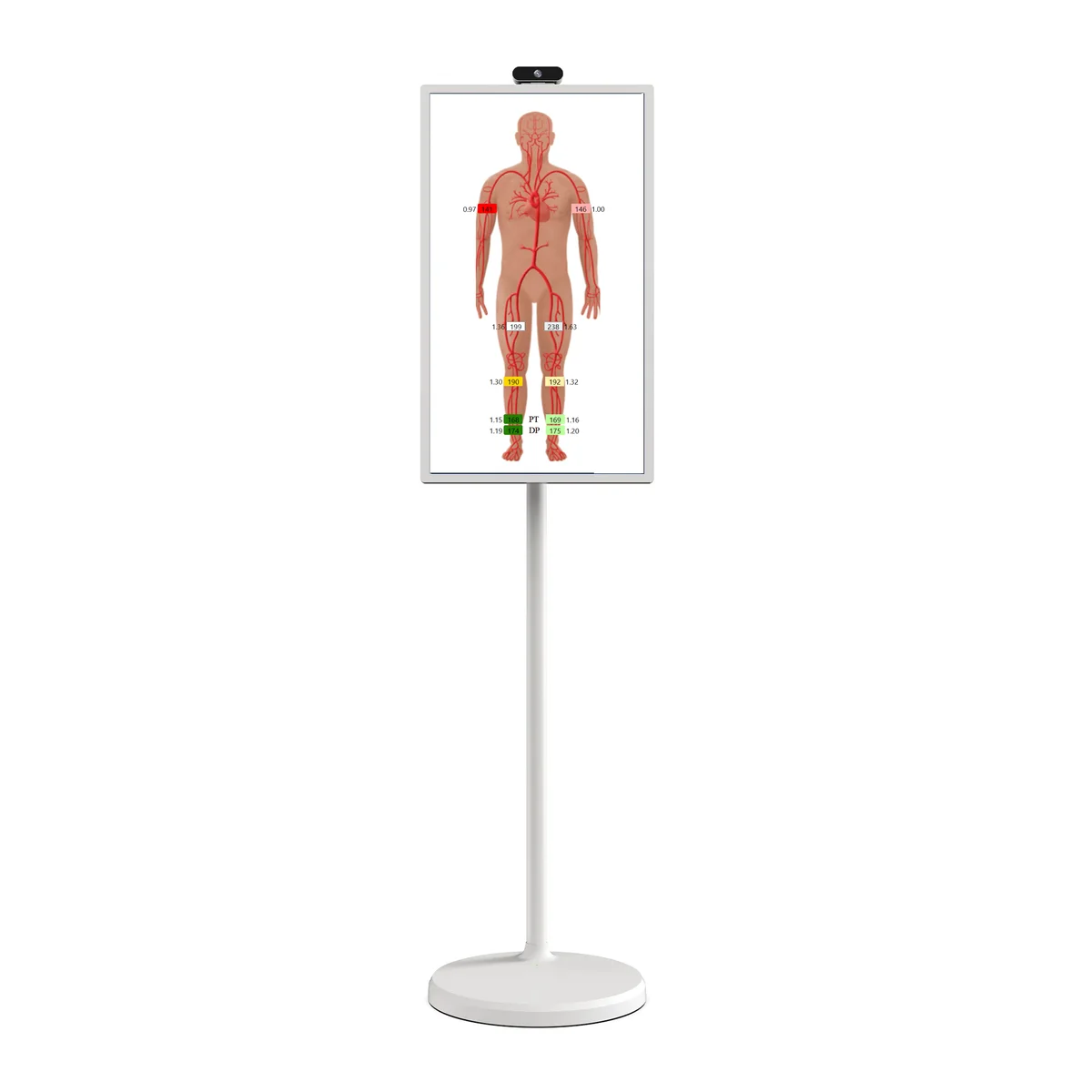 24-inch rolling display in portrait orientation showing a VasoGuard ABI report