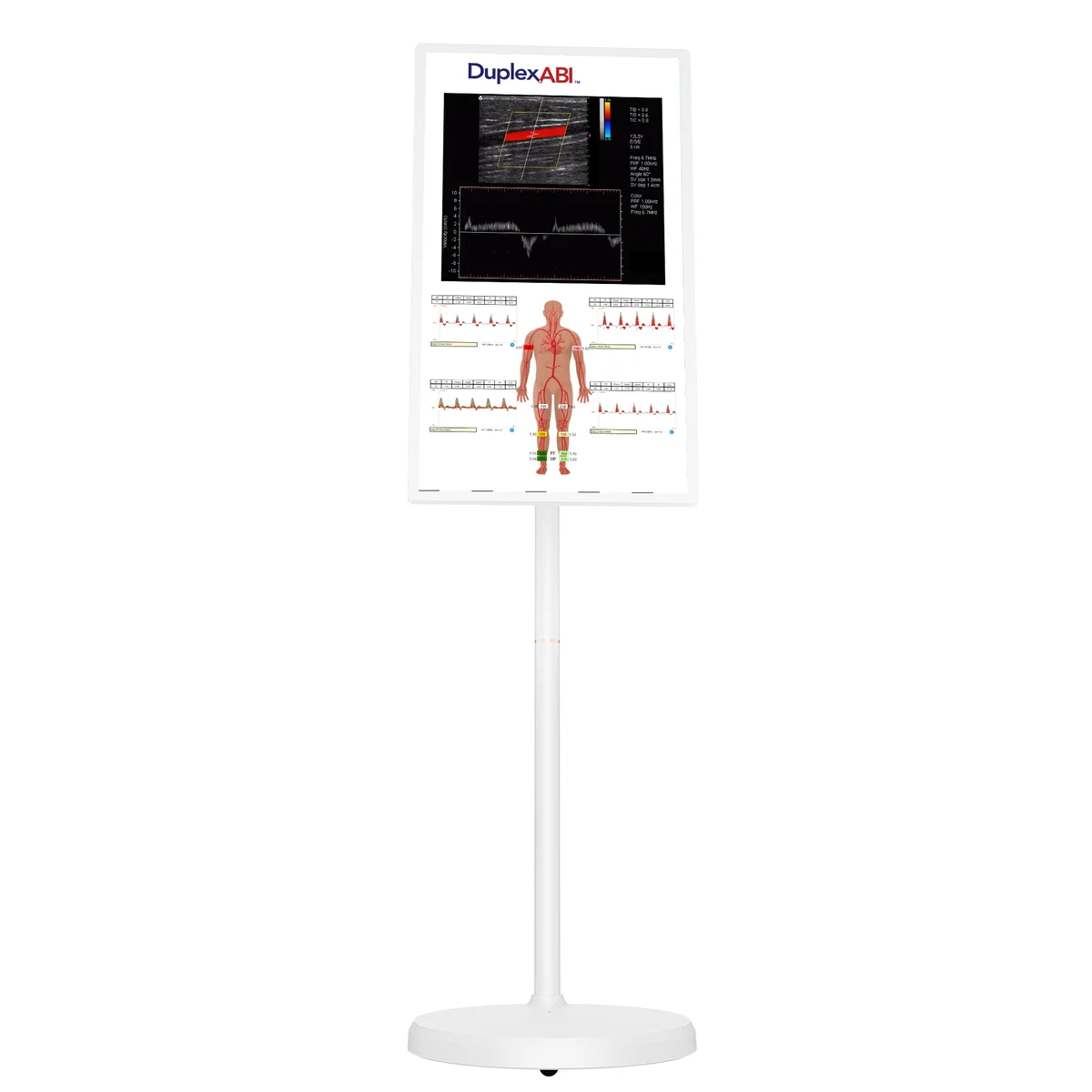 32-inch rolling display in portrait orientation showing a DuplexABI screen