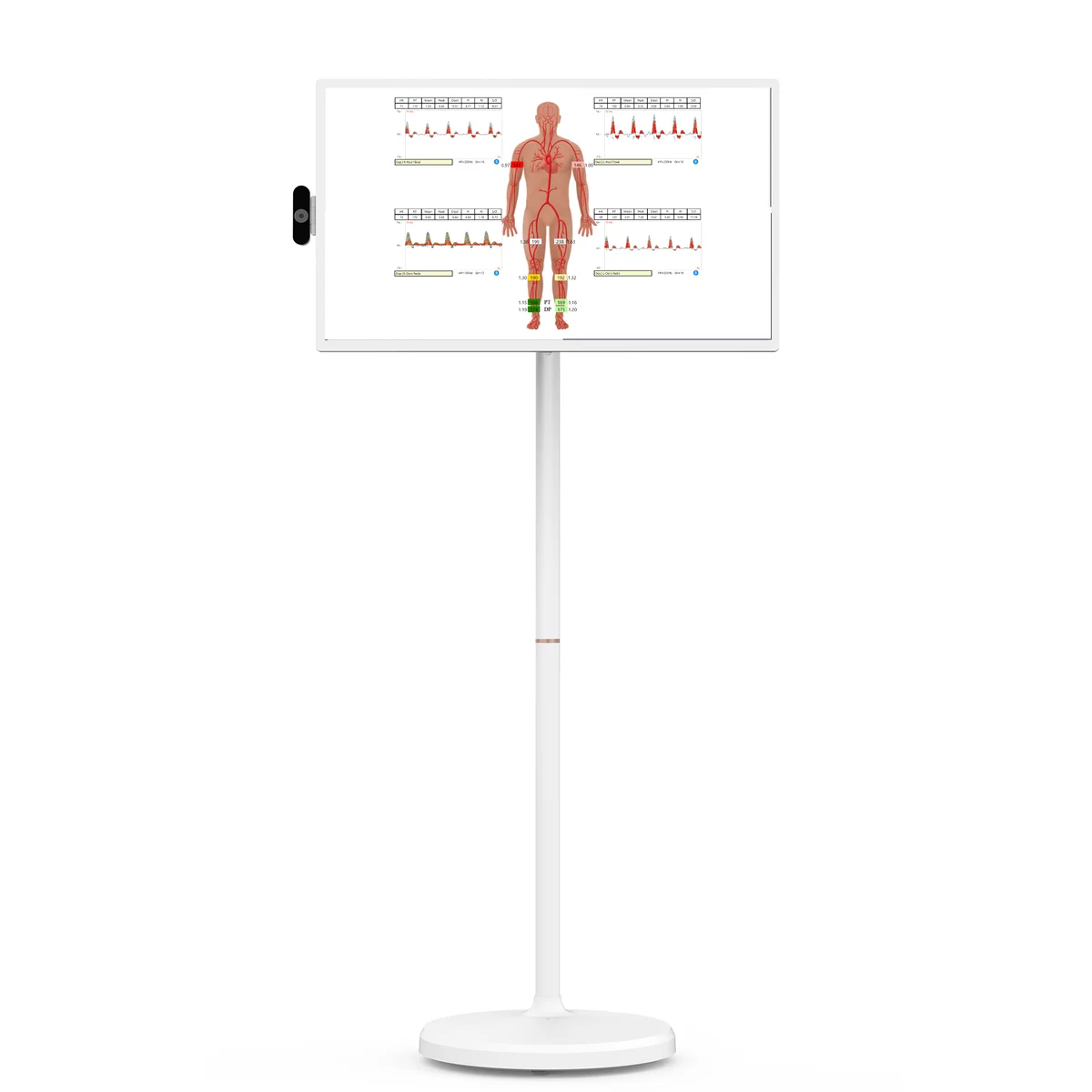 32-inch rolling display showing a VasoGuard ABI report with waveforms