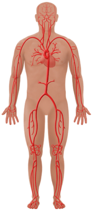 Body schematic with segmental cuff sites; a left/right volume mismatch at the ankle flags an improper wrap