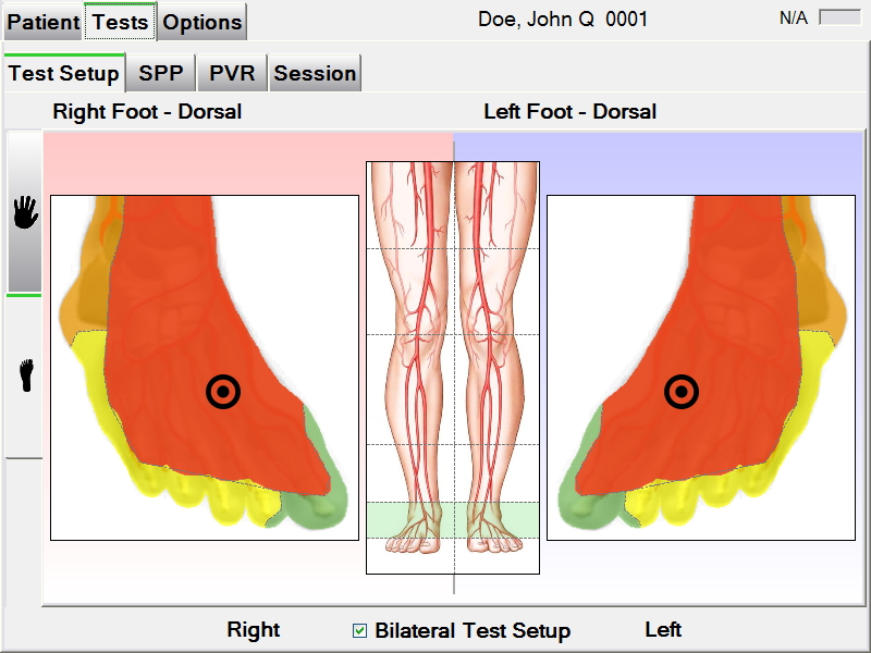 PAD-IQ Test Setup Screen showing bilateral dorsal foot testing