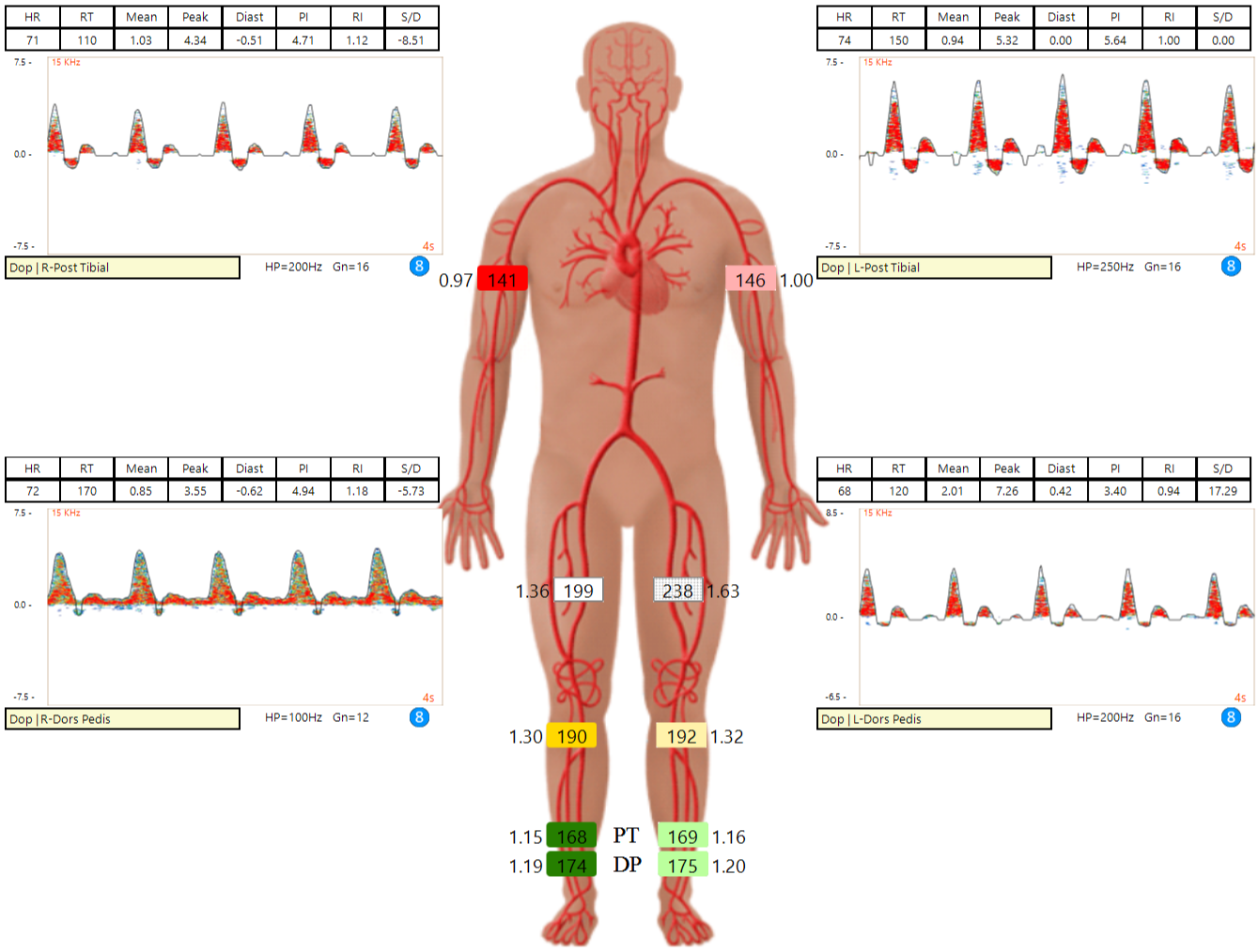 ABI Test Report