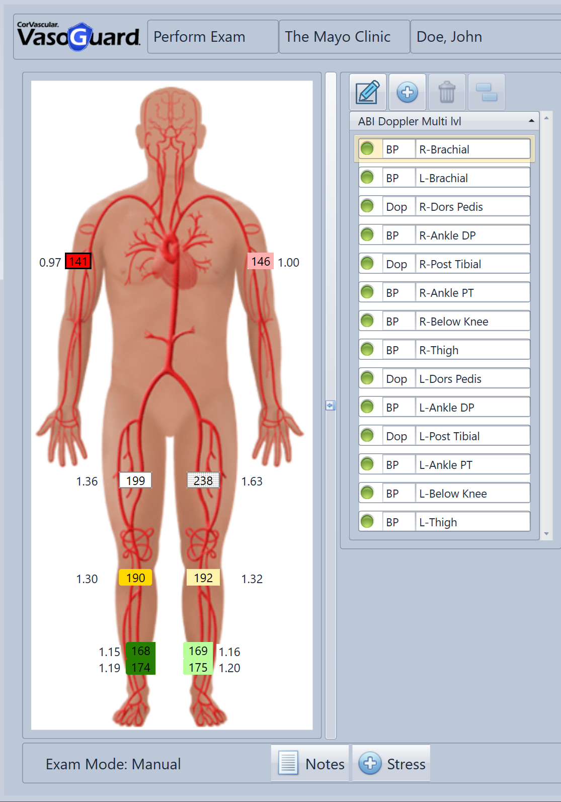 ABI Schematic Diagram